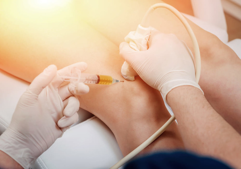 Fluoroscopic Guided Injection For Knee