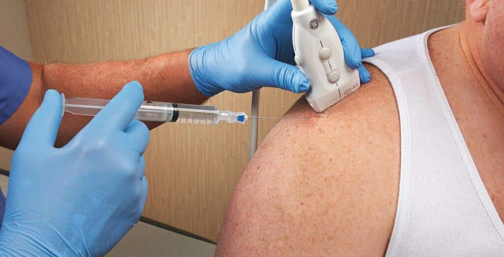 ultrasound-guided-injection-01