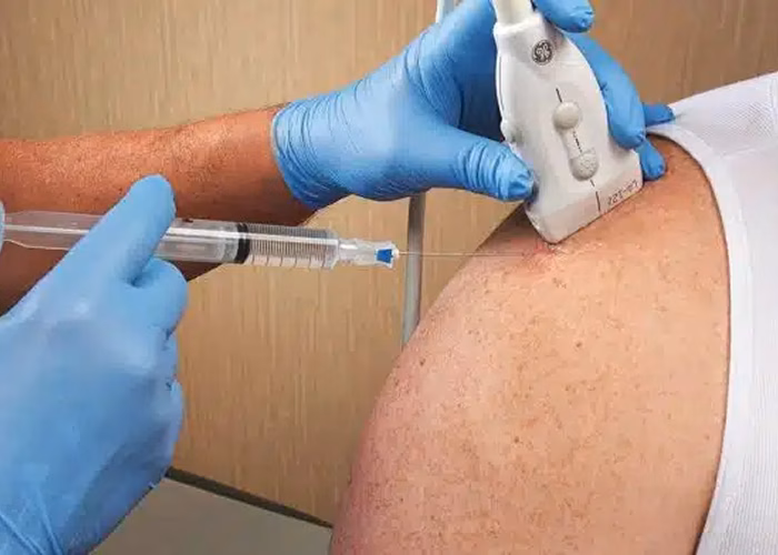 Ultrasound-Guided Injections be Combined with Other Procedures