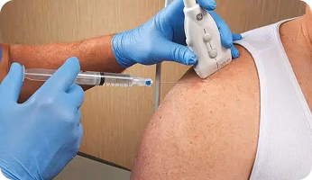 Ultrasound Guided Injection