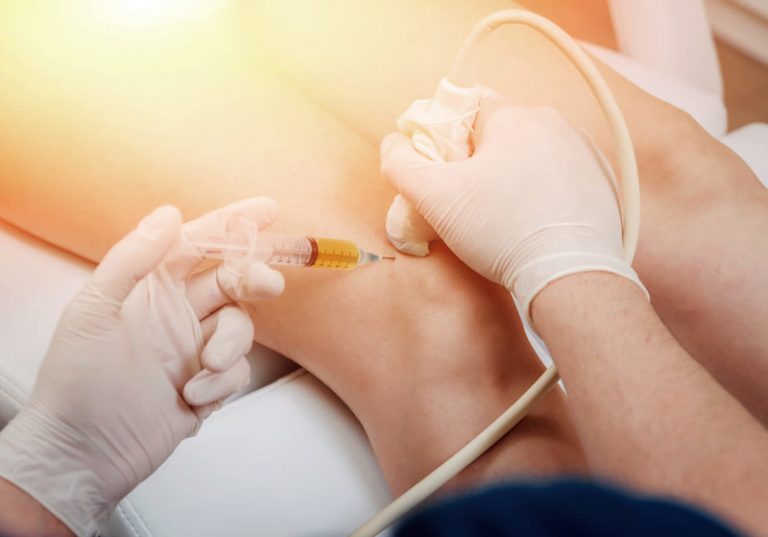 Fluoroscopic Guided Injection For Knee