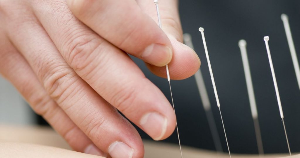 acupuncture-therapy-for-pain-brooklyn-clinic