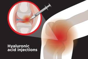hyaluronic-acid-ha-knee-injections-04