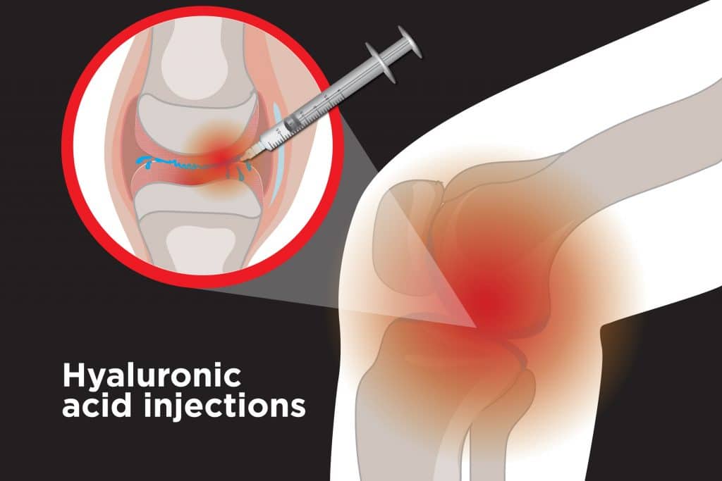 are hyaluronic acid knee injections painful