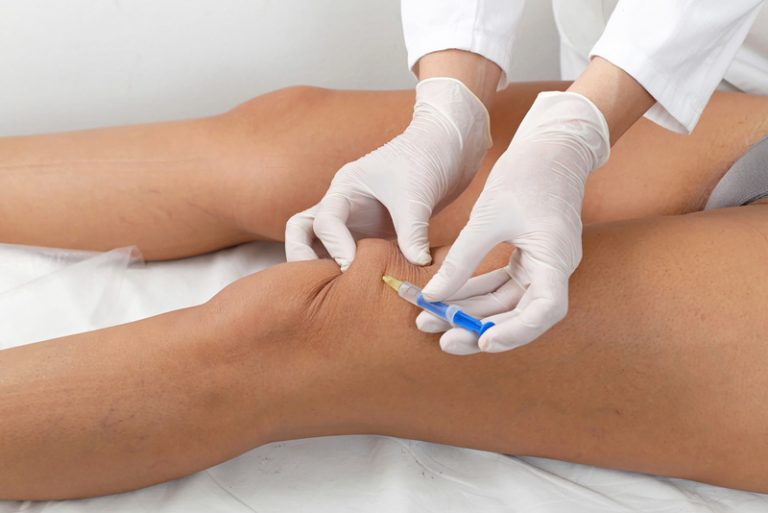 Injection for Knee Pain