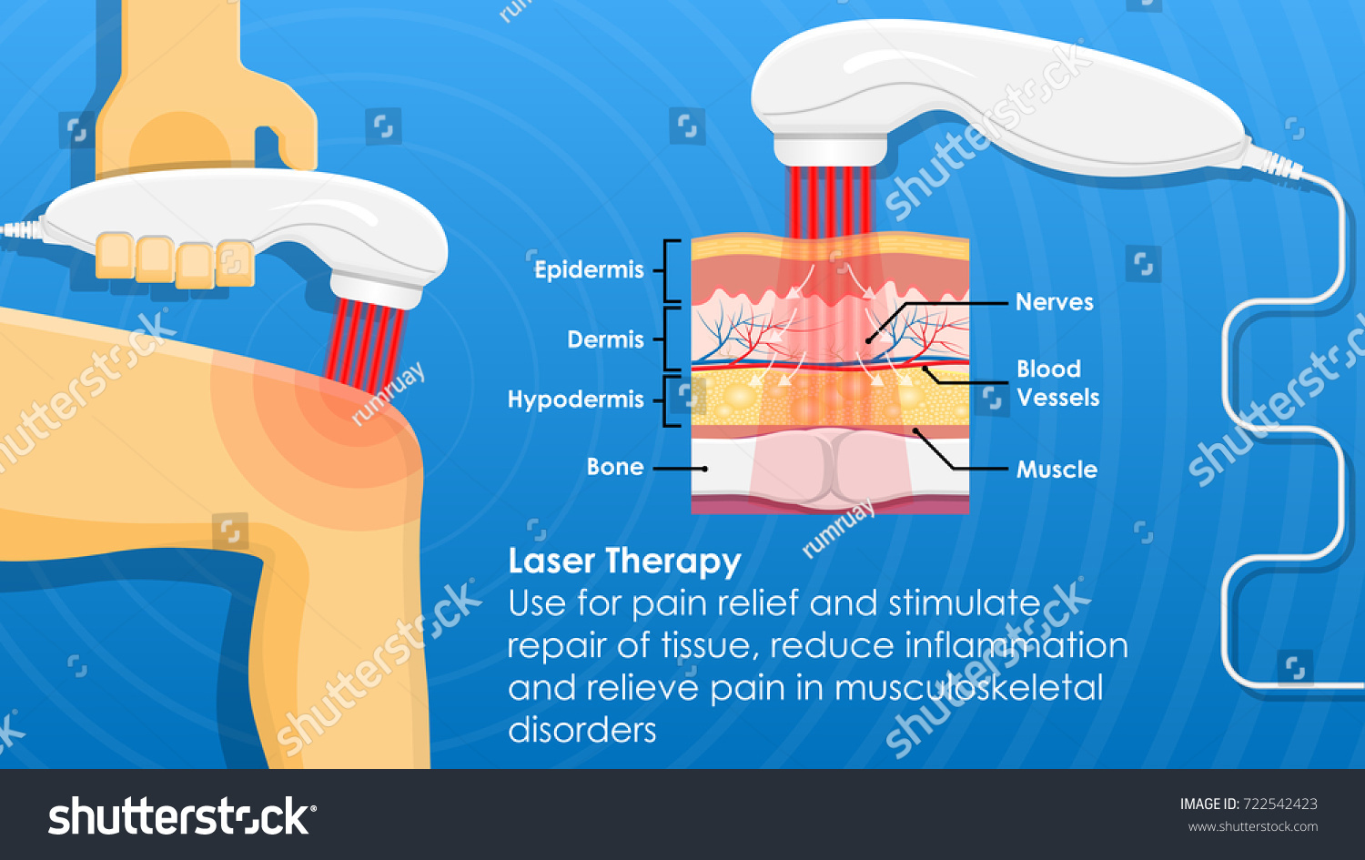 Laser Pain Therapy