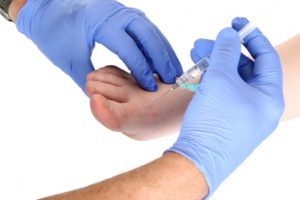 Perineural Injection Therapy